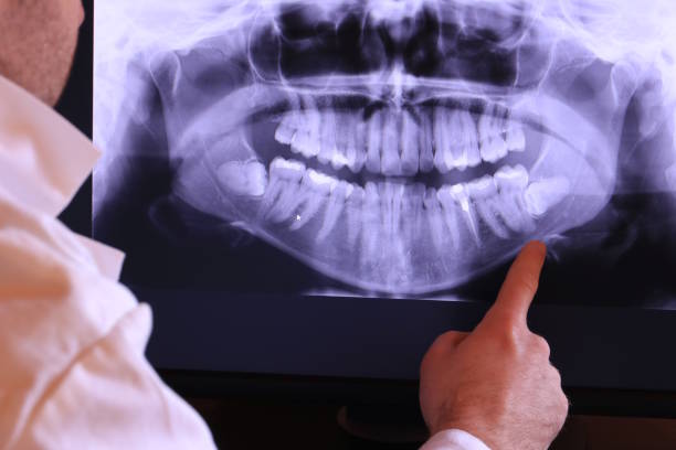 Best Knocked-Out Tooth Emergency  in Hillsborough, NJ