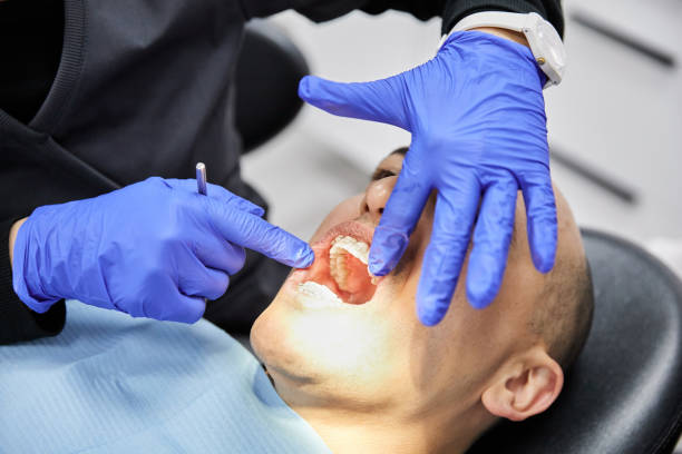 Best Dentist for Tooth Abscess  in Hillsborough, NJ